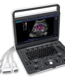 MÁY SIÊU ÂM XÁCH TAY 2D SONOSCAPE E3