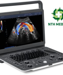 MÁY SIÊU ÂM XÁCH TAY 2D SONOSCAPE E2